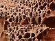 erosion